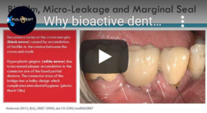 VIDEO zu Vorteilen von Bioaktivem Zahnzement